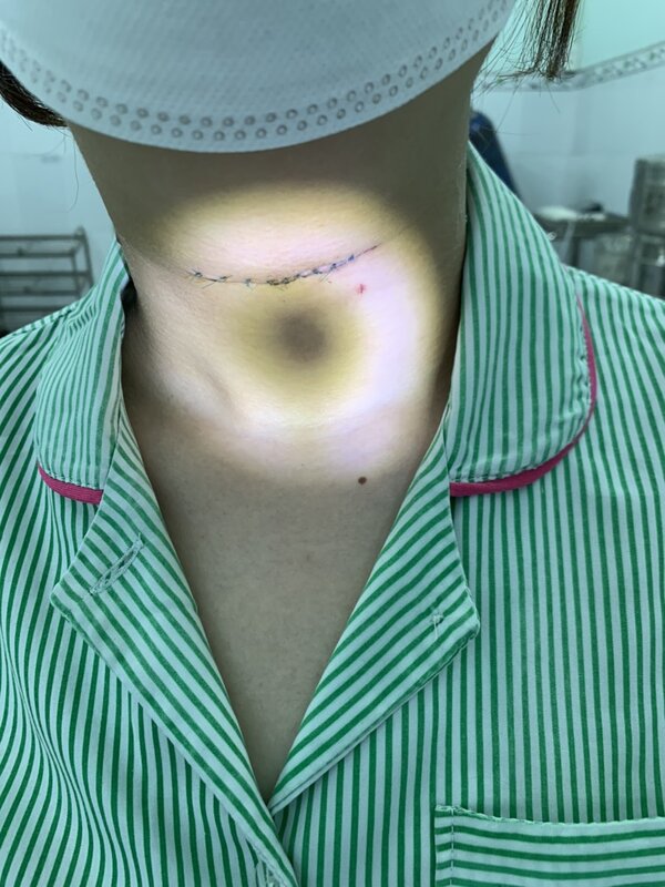 Tình trạng bệnh nhân sau mổ.