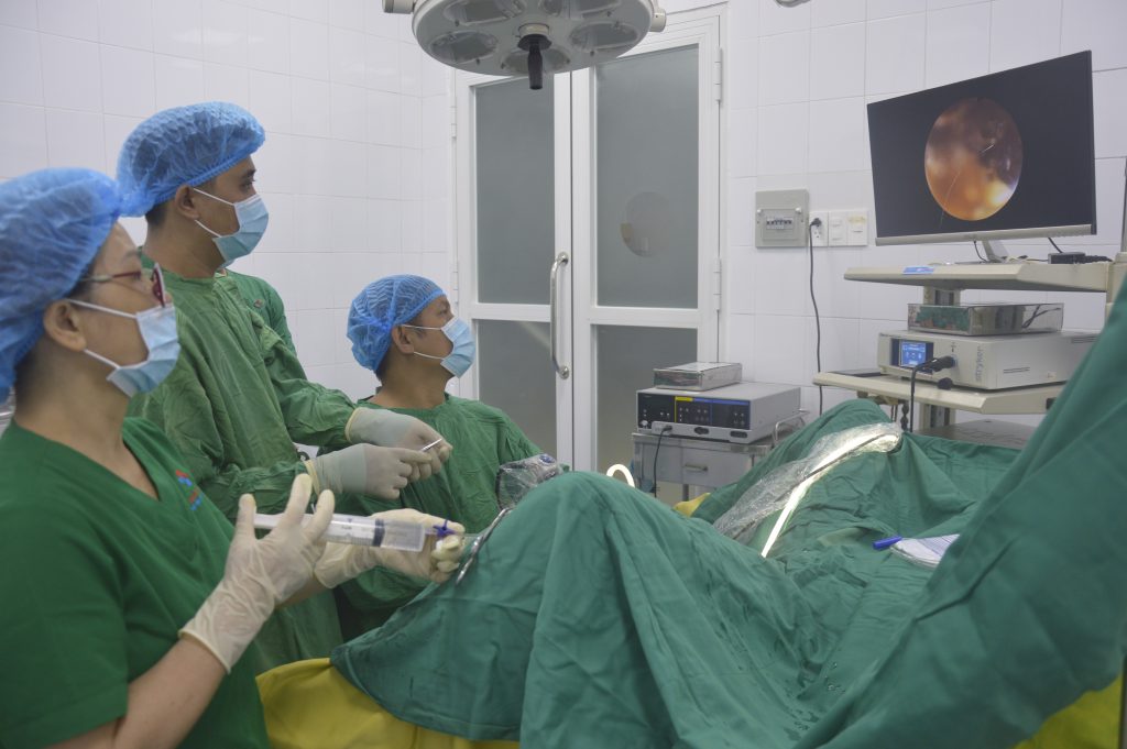 Tán sỏi bằng laser